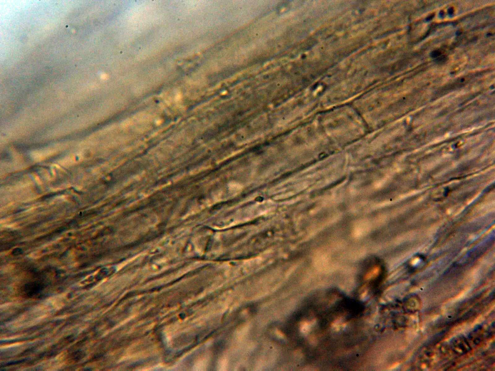 Microscopía de Pseudosperma squamatum - 10 - Suprapellis 2